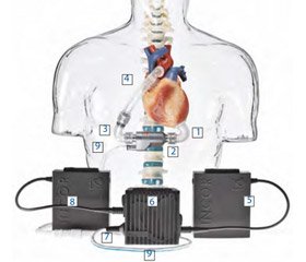 Sensitivity at heparin treatment in patients after LVAD implantation in early post operation period