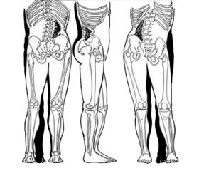 Analysis of clinical risks in victims with associated pelvic traumas