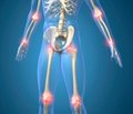 Obesity-Induced Osteoarthritis: the Multifactorial Interrelation and the Leading Role of Adipokines, Dyslipidemia and Mechanical Loading