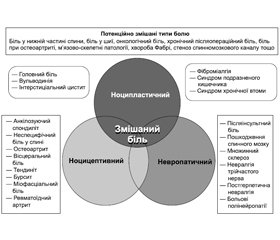 Сучасні концепції виникнення болю та можливості його подолання в загальній лікарській практиці