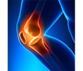 Innovative pain management in osteoarthritis