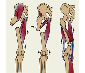 System analysis of operative method of treating diaphyseas fractures and influence factors on reparative regeneration