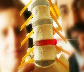 Clinical and diagnostic features vertebrogenic vertebral artery syndrome in patients with epileplii