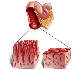 Impact of compliance to a gluten-free diet on vitamin and trace element deficiencies in celiac patients