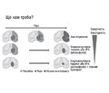 Стратегії церебропротекції при гострому ішемічному інсульті: вигадка чи реальність? Вебінар EVER Pharma (16 березня 2023 р.)