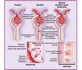 Блокаторы ренин-ангиотензиновой системы и функциональный резерв почек. Есть ли предел ренопротекции?