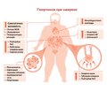 Стратегії схуднення для профілактики та лікування гіпертензії. Наукова заява Американської асоціації серця