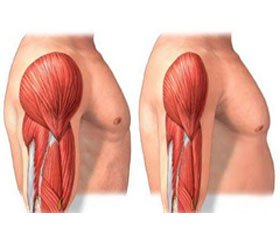 Pitfalls in the Development of Drugs in Sarcopenia