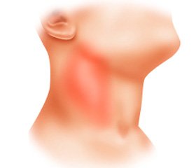 Relationship of the Parameters of Endogenous Intoxication with Fatty Acids in Patients with Phlegmons of the Maxillofacial Region 