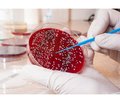 Інфекція Staphylococcus aureus у дітей: діагностика та лікування в умовах поширення антибіотикорезистентності