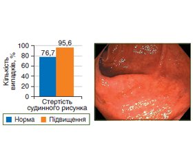 Ендоскопічні особливості слизової оболонки кишечника у хворих на виразковий коліт залежно від рівня IgG4