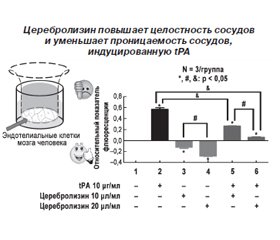 Современное лечение острого ишемического инсульта