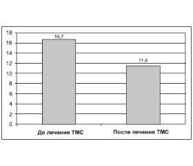 Лечение мигрени методом транскраниальной магнитной стимуляции